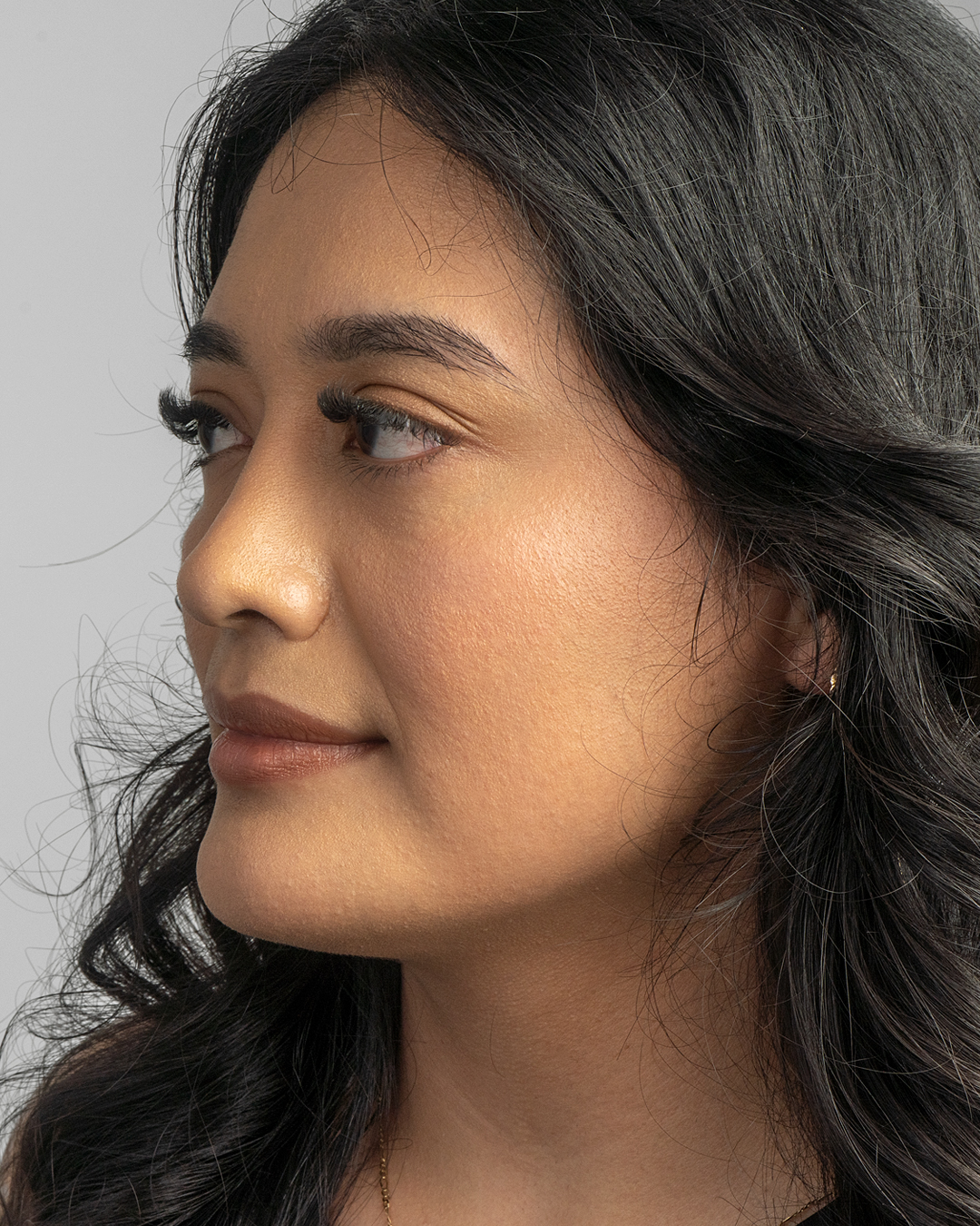 Refined facial profile after rhinoplasty by Dr. Ronald Espinoza